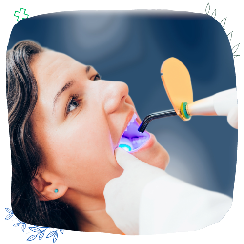 Fillings Img 2